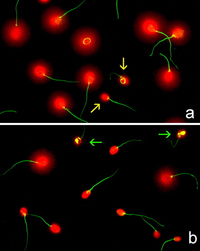 FIGURE 1  Sperm DNA fragmentation as visualized after application of the SCD test and staining using Gel Red. (a) Fresh sperm sample processed at baseline. Yellow arrows highlight sperm nuclei containing damaged DNA. (b) Fresh sperm sample after 24 h incubation. Green arrows show highly degraded sperm nuclei.