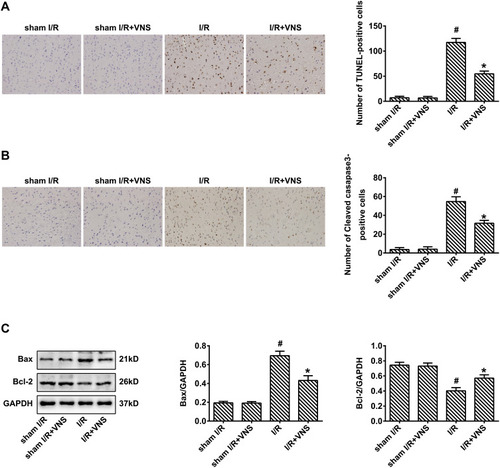 Figure 3 Vagal nerve stimulation attenuates apoptosis following ischemia–reperfusion injury. (A) Staining using terminal deoxynucleotidyl transferase dUTP nick end labeling indicated that obvious apoptosis was detected in rats who had undergone ischemia–reperfusion (I/R), and apoptosis was decreased after vagal nerve stimulation (VNS). (B) Immunohistochemical staining indicated that the expression of cleaved caspase-3 was increased in rats who had undergone I/R and decreased after VNS. (C) Western blot analysis indicated that the expression of Bax was increased in rats who had undergone I/R and decreased after VNS. The expression of Bcl-2 was decreased in rats who had undergone I/R and increased after VNS; #P < 0.05 vs sham I/R group, *P < 0.05 vs I/R group.