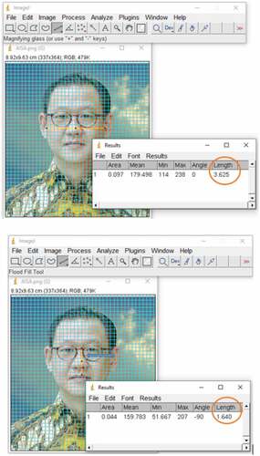 Figure 1. Illustration of measuring bizygomatic width and upper facial height (Hengky Koestanto, CEO of PT FKS Food Sejahtera Tbk)