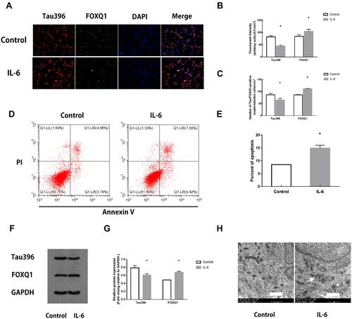 Figure 4 Changes in hippocampal neurons after IL-6 intervention. (A) Representative fluorescence images showing the distributions of tau396 (red), FOXQ1 (green) and nuclei (blue) in control hippocampal neurons and neurons co-cultured with IL-6. (B) Tau396/FOXQ1 expression was quantified based on the average of three independent images (n=6), *Ftau=0.120, P <0.001, *FFOXQ1=4.151, P <0.001 versus the Control group by t-test. (C) Quantification of tau396/FOXQ1-positive neurons (n=6), *Ftau=0.028, P <0.001, *FFOXQ1=8.000, P <0.001 versus the Control group by t-test. (D) Apoptosis in IL-6 co-cultured hippocampal neurons was evaluated by flow cytometry. The early apoptotic signal is localized to the A4 quadrant, and late apoptotic/necrotic signals are localized to the A2 quadrants of the dot-plot graphs. (E) Quantification of the percentage of apoptotic neurons. All samples were analysed in triplicate. Data are expressed as the mean ± SEM. *F=6.250, P=0.031 versus the Control group by t-test. (F) Representative Western blots showing Tau396 and FOXQ1 expression. GAPDH was used as a loading control. (G) Quantification of the relative protein expression of Tau396 and FOXQ1 in 2 groups (n=6), *Ftau=0.053, P <0.001, *FFOXQ1=0.109, P <0.001 versus the Control group by t-test. (H) Transmission electron microscopy: arrows indicate mitochondria swelling, vacuolation and endoplasmic reticulum dilatation in hippocampal neurons co-cultured with IL-6 (5000×). Scale bar = 1 μm.