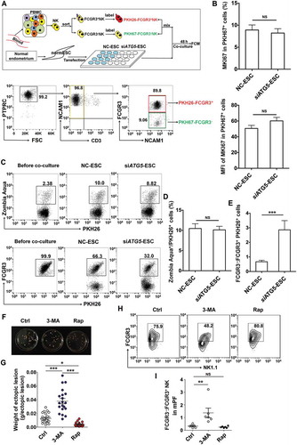 Figure 3. The low autophagy of ESCs triggers more differentiation of FCGR3− NK cells from FCGR3+ NK cells. (a,e) FCGR3+NK and FCGR3− NK cells were sorting from peripheral blood NK cells, and then labeling with PKH26 and PKH67, respectively. Then, PKH26-FCGR3+ NK and PKH67-FCGR3− NK cells (n = 6) were mixed and further cocultured with NC-ESC and siATG5-ESC (a). After 48 h, the positive ratio and MIF of MKI67 in PKH67+ NK cells (b), Zombie Aqua+ dead PKH26+ NK (c,d), and the differentiation of PKH26-FCGR3+ NK to PKH26-FCGR3− NK cells (c,e) were analyzed by FCM (Student t test). (f,g) The size and weight of EMS-like lesions from the EMS mouse model treated with vehicle, 3-MA (100 mg/kg/d) or Rap (100 mg/kg/d) (n = 6 mice/group) were measured (one-way ANOVA). (h,i) The C57BL/6 EMS mouse model was constructed, and treated with vehicle, 3-MA (100 mg/kg/d) or rapamycin (Rap, 100 mg/kg/d) (n = 6 mice/group) on day 3 and day 10 after surgery. Then the ratio of FCGR3−:FCGR3+ NK cells in PF was analyzed by FCM (one-way ANOVA). Data are expressed as the mean± SEM. **P < 0.05, **P < 0.01 and ***P < 0.001. NS, no statistical difference.