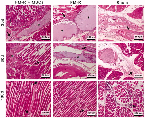 Figure 6. Representative H&E-stained sections of the muscle explants retrieved from subjects with VML injury at 30, 60 and 180 days post-transplantation. Asterisks indicate the microbeads, black arrows indicate the capillaries. Scale bars: 300 µm.