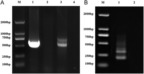 Figure 4. Electrophoresis of the nested-PCR amplification products in 2% agarose gels. (A) DNA products amplified in first-round PCR using the universal primers ITS1 and ITS4. Lane M, 2 kb DNA ladder. Lane 1, product amplified from Aspergillus fumigatus DNA as positive control. Lane 2, negative control, no amplification product by using DNA extracted from laser microdissected adjacent areas without fungal spores in the identical field of the same tissue section. Lane 3, products amplified from fungal DNA extracted from LCM-isolated FFPE tissue. Lane 4, no-template control. (B) Nested PCR products obtained by using the first-round PCR products as templates and ITSC1 and ITSC2 as the Coccidioides-specific primers. Lane M, 2 kb DNA ladder. Lane 1, nested PCR products obtained by using the first-round PCR products as templates. Lane 2, no product obtained by using first-round PCR products, amplified from A. fumigatus DNA, as templates.