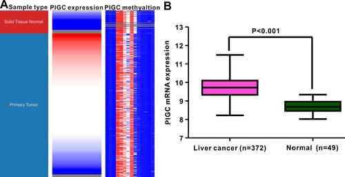 Figure 2 Correlation between PIGC mRNA expression and PIGC DNA methylation. (A) Heat map of PIGC expression and its DNA methylation in cancerous liver specimens and normal liver tissues. (B) PIGC mRNA expression is higher in cancerous liver tissues (N=372) than that in normal liver tissues (N=49).