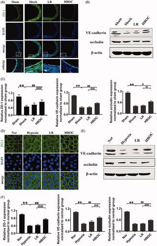 Figure 5. Effects of HBOC on the expression of intercellular junction proteins in haemorrhagic shock/hypoxia. (A) ZO-1 levels (green) after haemorrhagic shock (bar = 50 μm). (B) VE-cadherin and occludin levels after haemorrhagic shock. (C) Quantification of ZO-1, VE-cadherin and occludin levels in vivo. (D) ZO-1 levels (green) after hypoxia treatment (bar = 10 μm). (E) VE-cadherin and occludin levels after hypoxia treatment. (F) Quantification of ZO-1, VE-cadherin and occludin levels in vitro. Data are presented as mean ± SD (n = 8 observations per group). Date are presented as mean ± SD, each group contains eight observations, *p < 0.05 and **p < 0.01 as compared with sham operation group/normal group, #p < 0.05 and ##p < 0.01 as compared with shock/hypoxia group, @p < 0.05 and @@p < 0.01 as compared with LR group. HBOC: haemoglobin based oxygen carrier; LR: lactated Ringer's solution; Nor: normal group; Sham: sham operation group.
