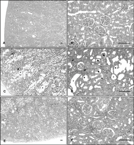 Figure 1. Histological examination of rat kidney, from the regions of cortex. (A, B) Control rat kidney, showing normal morphology. (C, D) Cisplatin-treated rat kidney, showing massive dilation of tubules (asterisk), tubular necrosis (arrowhead), cast formation in the lumen (arrowhead-ball), and focal mononuclear cells infiltration (arrow). (E, F) Cisplatin + vitamin C-treated rat kidney, showing slight dilation of tubules and degenerative changes (hematoxylin + eosin, scale bar: 100 μm).