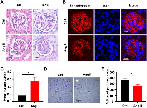 Figure 1. Angiotensin II-induced podocyte detachment and impaired kidney function. (A) Representative images of HE and PAS staining in normal saline (ctrl) and Ang II-infused mice. Scale bars:20µm. (B) Representative immunofluorescent staining of synaptopodin (podocyte‐specific marker, red) and DAPI (blue) in different groups, Scale bars:20µm. (C) Quantitative determination of 24h urine Total protein (UTP) in ctrl and Ang II-infused group (n = 6), *p < 0.05. (D) Representative images of adhesion assays in ctrl and Ang II-treated podocytes in cultures. Scale bars = 250µm. (E) Quantitative determination of podocyte numbers in ctrl and Ang II-treated podocytes in cultures (n = 5), *p < 0.05.