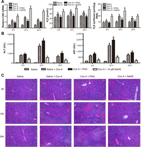 Figure 1 H2S pretreatment ameliorates Con A-induced hepatitis.