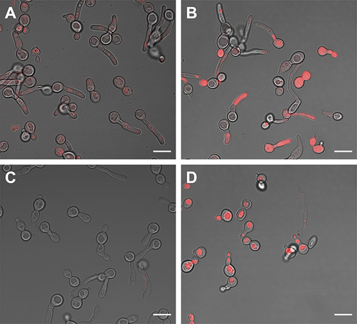 Figure 8 Representative confocal microscopy images of C. albicans yeast cells after incubation for 10 min with: (A) ZnP-hexyl; (B): AgNPs-ZnP-hexyl; (C): ZnP-ethyl; (D): AgNPs-ZnP-ethyl. AgNPs:ZnPs were applied at a ratio of 1:4 v/v. Scale bar: 10 µm.