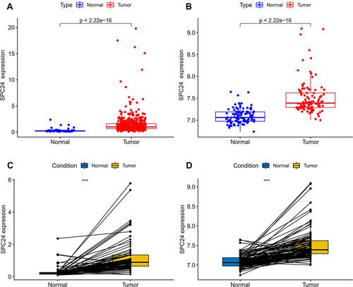 Figure 1 SPC24 was significantly overexpressed in ccRCC. (A) SPC24 was significantly upregulated in ccRCC compared to kidney tissues in TCGA database. (B) SPC24 was significantly upregulated in ccRCC compared to kidney tissues in GEO database. (C and D) SPC24 was expressed at higher levels in ccRCC compared to non-cancerous adjacent tissues in TCGA and GEO database. ***P<0.001.