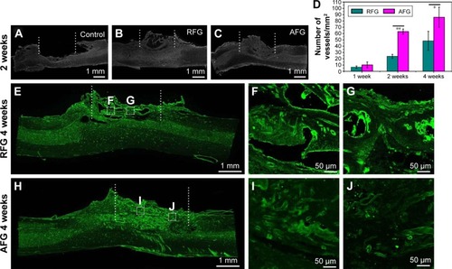 Figure 2 Vascularization in the dorsal hemisected site. (A–C) Representative sagittal sections of control, RFG, and AFG groups stained by DAPI show the tissue regeneration at 2 weeks post-surgery, and the lesion site region is labeled by dashed line. (D) Quantification of RECA-1 positive vessels at the middle site of injury at 1, 2, and 4 weeks after spinal cord injury. *p < 0.05, **p < 0.01 for the comparison of RFG and AFG. Four individual rats per group were used for statistical analysis (n = 4), and five confocal images per rats were used for the vessel counts. Immunofluorescence staining images of the T8–T10 sagittal sections in RFG (E–G) and AFG (H–J) groups labeled by RECA-1 (green).Abbreviations: AFG, aligned fibrin hydrogel; DAPI, 4′,6-diamidino-2-phenylindole; RFG, random fibrin hydrogel.