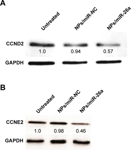 Figure 8 Western blot analysis of protein expression in HepG2 cells.Notes: The protein expression of CCND2 (A), CCNE2 (B) after treatment with different nanoparticles. Untreated, NPs/miR-NC, NPs/miR-26a: HepG2 cells treated with no nanoparticles, PEI/QD/miR-NC, PEI/QD/miR-26a nanocomplex, respectively.Abbreviations: PEI, polyethyleneimine; QD, quantum dot; NC, negative control; NP, nanoparticle.