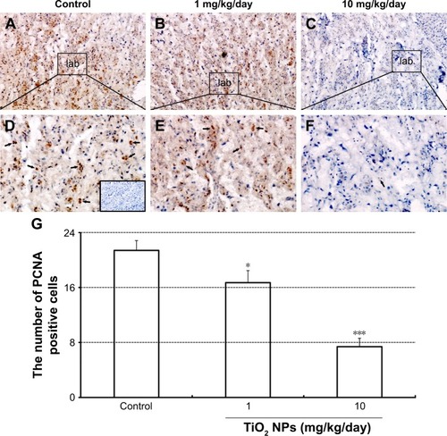 Figure 8 Effect of TiO2 NP exposure on the proliferation of placenta.Notes: (A–B) PCNA immunohistochemical staining of whole placental sections collected from animals, which were administered by control (A), 1 (B) and 10 mg/kg/day (C) TiO2 NPs. Boxed areas in A–C were imaged with two-times higher magnification (D–F, respectively). Inset of D shows immunostaining of a negative control section (primary antibody was replaced by normal rabbit serum). (G) The numbers of PCNA-positive cells in placental labyrinth of mice on GD 13. Data are presented as means ± SEM of 6 animals. *P<0.05, ***P<0.001 compared with control.Abbreviations: TiO2 NPs, titanium dioxide nanoparticles; lab, labyrinth; GD, gestational day; SEM, standard error of mean.