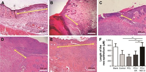 Figure 10 The effect of PCL/NS1.0 on re-epithelialization.Notes: Representative histological images of the length of the newly generated epidermis taken at day 7 post surgery in the (A) blank, (B) control, (C) PCL, (D) PCL/DA and (E) PCL/NS1.0 groups. The yellow double-headed arrows refer to the length of the newly generated epidermis. (F) Calculation of the length of the newly generated epidermis at day 7 post surgery. Data are presented as mean ± SD (n=4), and the significant difference between the PCL/NS1.0 group and the control, PCL or PCL/DA group, **p<0.01. Scale bars: 200 µm. Magnification ×100.Abbreviations: DA, dopamine; NS, nanosilver; PCL, polycaprolactone.