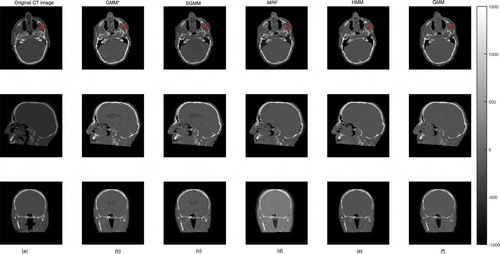 Figure 5. The first column (a) presents the original CT image slices and the remaining columns (b)–(f) show the corresponding predicted slices of CT image.