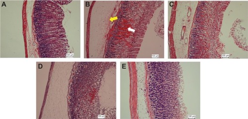 Figure 5 Histopathological staining of gastric tissues after treatment with EEAM at (C) 200 mg/kg and (D) 400 mg/kg doses, and (E) omeprazole, using H&E staining (20×). (A) and (B) are presenting the normal control and lesion control groups, respectively. In the lesion control group, there are clear signs of severe damage to the surface epithelium (white arrow) and leukocyte infiltration (yellow arrow).