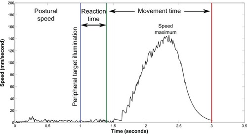 Figure 5 Movement parameters calculated from tangential velocity data recorded by the RoboTherapist 2D robotic device as described in Coderre et al.Citation5