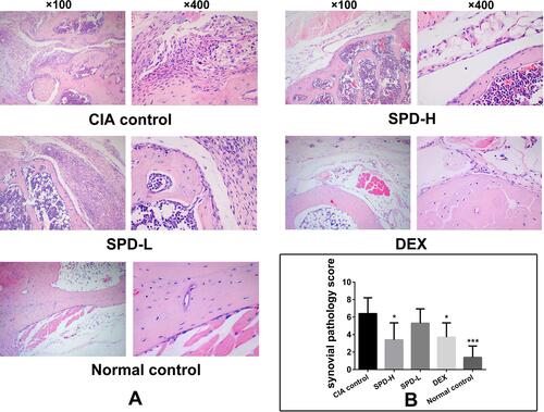 Figure 3 Histopathological observations of ankle joints. (A) Representative histological sections of ankle joints stained with HE. (B) Synovial pathology score of each group. Data are presented as mean ± standard deviation from five animals and analyzed using single-factor analysis of variance followed by the least significant difference test. *P < 0.05, ***P < 0.001 vs CIA control group.