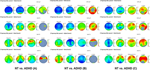 Figure 3 The difference in topography between the three ADHD subtypes and the NT group divided by cluster analysis of QEEG.