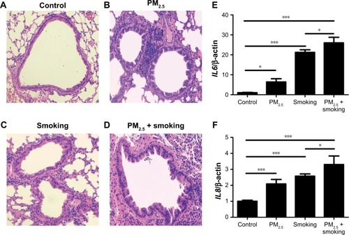Figure 1 PM2.5 aggravated smoking-induced histological changes and inflammation in lungs of mice.