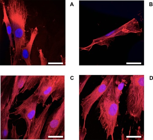 Figure 8 Actin staining epifluorescent images of human fibroblasts (A) no DEX; (B) LPS; (C) LPS+ DEX-P and (D) DEX from release buffer after 24-hr exposure assessed by confocal microscopy. Actin rings and nuclei of cells were stained with phalloidin-FITC and DAPI, respectively. Bar corresponds to 20 µm.Abbreviations: LPS, lipopolysaccharides; DEX, dexamethasone; DEX-P, dexamethasone phosphate.