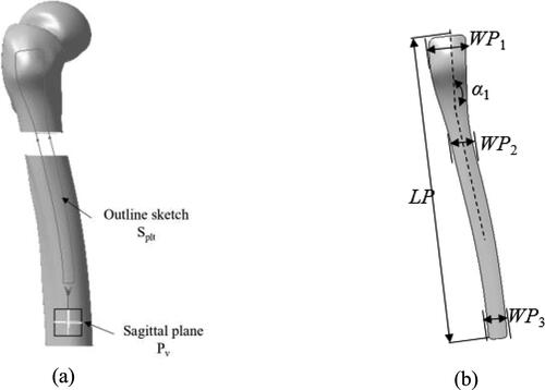 Figure 4. Creation and parameterization of outline of anatomic plate. Outline sketch creation (a) and outline parameterization (b).