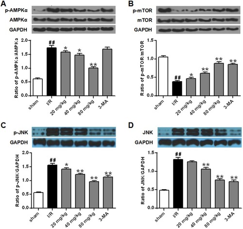 Figure 6 Effects of different doses of stigmasterol on the expression and phosphorylation of AMPKα (A), mTOR (B), and JNK (C, D) in rats with cerebral ischemia/reperfusion injury. 3-MA was chosen as the positive control. n=6. ## p<0.01 vs sham group; *p<0.05, **p<0.01 vs ischemia/reperfusion group.