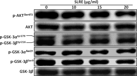 Figure 6. Effect of SLRE on AKT/GSK-3 signaling pathway in SH-SY5Y cells. Cells lysates were subjected to 10% SDS-PAGE and the levels of p-AKTSer473, AKT, p-GSK-3αSer21, p-GSK-3βSer9, p-GSK-3αtyr279/βtyr216, and GSK-3β proteins were detected by western blotting.