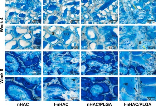 Figure 5 Histological evaluation of bone formation in mandible bone defects at the fourth and eighth week by toluidine blue staining (black arrows: osteocytes in bone lacuna, yellow arrows: osteoblasts).Abbreviations: NB, new bone; nHAC, nano-hydroxyapatite/collagen; OS, osteoid; PLGA, poly lactic-co-glycolic-acid; S, composite scaffold.