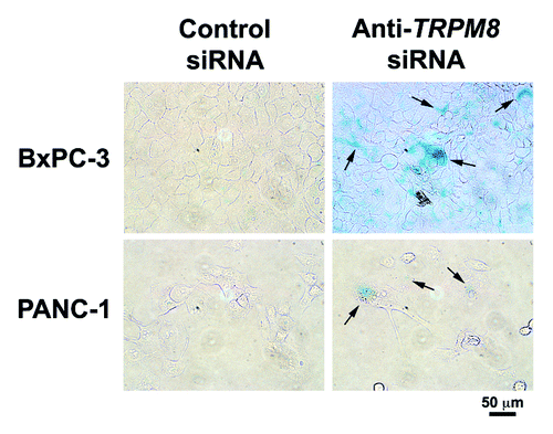 Figure 5. RNA interference-mediated silencing of TRPM8 induced replicative senescence. The BxPC-3 and PANC-1 cells were transfected with either anti-TRPM8 siRNA or non-targeting control siRNA and then seeded at 4 x 104 cells / 2 ml medium in each well of a 12-well cell culture cluster (Corning Inc., costar). The transfected cells were incubated at 37°C for 72 h, and then analyzed for activity of SA β-gal using the Senescence Detection Kit (Biovision Medical Products) according to the manufacturer’s instructions. Images were acquired under an inverted light microscope with phase contrast (Nikon TE-300) and processed using Adobe Photoshop CS3 extended. Appearance of blue color indicates SA β-gal activity (arrows), which is detected in the anti-TRPM8 siRNA-transfected cells but not in those transfected with control siRNA.