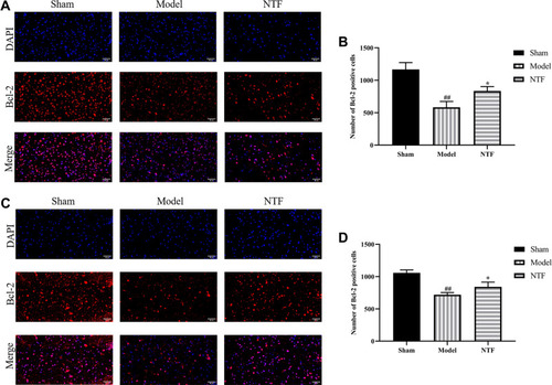 Figure 13 Effects of NTF 7 days prior to CIRI on expression of Bcl-2 of the ischemic cortex and hippocampus in rats 24 h after reperfusion. (A) Representative images magnified 400 times in ischemic cortex sections examined with specific antibody against Bcl-2 (red); nuclei were stained with DAPI (blue). (B) The numbers of Bcl-2 positive cells in each group after 24 h of reperfusion in ischemic cortex. (C) Representative images magnified 400 times in ischemic hippocampus sections. (D) The numbers of Bcl-2 positive cells in each group after 24 h of reperfusion in ischemic hippocampus. All data were presented as mean ± SD. ##p<0.01 versus sham group; *p<0.05 versus model group, respectively.