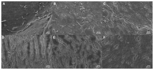 Figure 5 Scanning electron micrographs of C2C12 myoblasts cultured (four days) on electrospun scaffolds. (A) 5PU, (B) SWNT-5PU, (C) MWNT-5PU, (D) 10PU, (E) SWNT-10PU, and (F) MWNT-10PU. Scale bars are 20 μm.Abbreviations: MWNT, multiwalled nanotubes; SWNT, single-walled nanotubes; 5PU, 5% w/v polyurethane; 10PU, 10% w/v polyurethane.