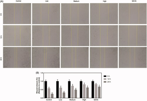 Figure 2. Resveratrol suppresses migration ability of ACHN cells. Migration ability of ACHN cells was demonstrated by representative image of migration assay (A) and quantification of the (B) migration experiment. All data were expressed by means ± SEM. *p < 0.05, **p < 0.01 vs. 0 h.