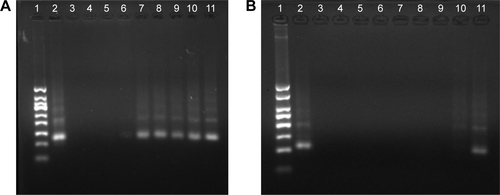 Figure S1 Gel electrophoretic analysis of sediment and supernatant from DOX loading experiment.Notes: (A) Analysis of sediment (1: 50 bp marker, 2: TD control, 3: 500 μM, 4: 400 μM, 5: 300 μM, 6: 250 μM; 7: 200 μM, 8: 150 μM, 9: 100 μM, 10: 50 μM, 11: 10 μM). (B) Analysis of supernatant (1: 50 bp marker, 2: TD control, 3: 500 μM, 4: 400 μM, 5: 300 μM, 6: 250 μM; 7: 200 μM, 8: 150 μM, 9: 100 μM, 10: 50 μM, 11: 10 μM).Abbreviations: TD, tetrahedron; DOX, doxorubicin; bp, base-pair.