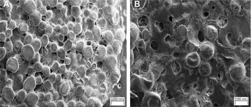 Figure 2 SEM micrographs of the prepared liposomes of DNP.