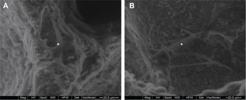 Figure 8 Scanning electron microscopy images of MC3T3-E1 cells attached and spread on the surfaces of (A) nanofluorapatite (n-FA)/polyamide 12 (PA12) composite with 40 wt% n-FA and (B) PA12 at 3 days.Note: *Represents cells.