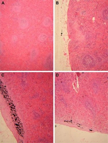 Figure 5 Histopathological effects of GONs on the spleen of rats after 21 days. Representative photomicrograph of (A) control group (H&E, ×100), (B) Rats receiving 50 mg/kg of GONs (H&E, ×100), (C) rats receiving 150 mg/kg of GONs (H&E, ×100), and (D) Rats receiving 500 mg/kg of GONs (H&E, ×100).Note: Black arrows indicate the accumulation of GONs.Abbreviations: GONs, graphene oxide nanoplatelets; H&E, hematoxylin and eosin.