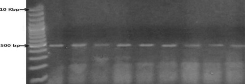 Figure 1. PCR amplification of 16S rRNA of 9 bacterial isolates. Lane M: 10 kb DNA marker. Lanes 1–9: The nine bacterial isolates. The amplicon size is 500 bp.