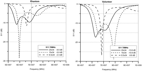 Figure 10. Measured reflection loss (S11) as function of frequency for the three waveguides (20 × 34, 15 × 34 and 8.5 × 34 cm). All waveguides are positioned on top of the phantom with a 6 cm bolus in the left graph, and positioned on the chest of a volunteer with ∼6 cm upper bolus in the right graph.