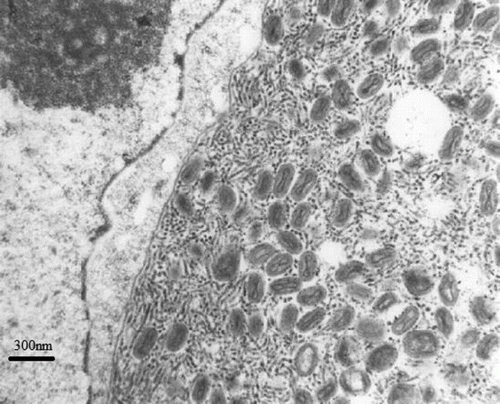 Figure 4.  Detail of Figure 3 illustrating enveloped dumbbell-shaped viral particles typical for poxvirus.