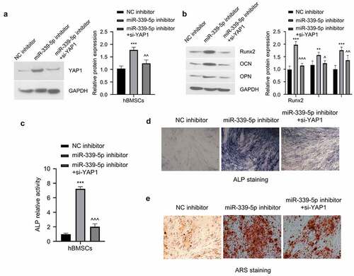 Figure 6. Knockdown of YAP1 partially reverses the effect of miR-339-5p inhibitor on the osteogenic differentiation of hBMSCs. (a) The expression of YAP1 in hBMSCs following treatment of miR-339-5p inhibitor with or without si-YAP1 silencing. (b) The expression of Runx2, OCN and OPN were analyzed in hBMSCs following treatment of miR-339-5p inhibitor with or without si-YAP1 silencing. (c-e) Osteogenic differentiation of hBMSCs was evaluated by ALP activity, ALP staining and ARS staining upon treatment of miR-339-5p inhibitor with or without si-YAP1 silencing.