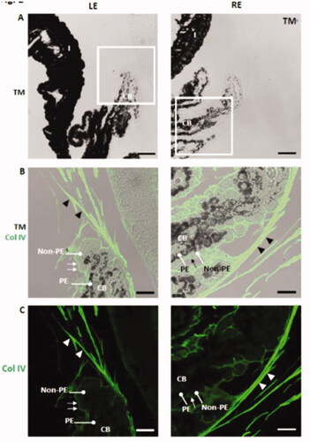 Figure 10. Increased deposition of collagen IV in the zonular fibers (arrowheads) and in the basement membrane of the non-pigmented epithelium (arrows) at the ciliary body in dexamethasone-injected rat eyes. LE: left eye; RE: right eye (injected with dexamethasone-loaded microspheres); CB: ciliary body; non-PE: non-pigmented epithelium; PE: pigmented epithelium; TM: transmission mode. Scale bars: (A) 43.48 μm; (B, C) 18.18 μm.