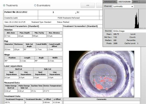 Figure 4 Digital analysis of extent of OBL.