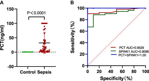 Figure 3 SPINK1 and PCT have high diagnostic efficiency for sepsis. (A)The PCT in sepsis group was significantly higher than that in normal group, and the difference was statistically significant (P<0.0001). (B) The true positive rate (sensitivity) and false positive rate (specificity) of SPINK1, PCT and SPINK1 combined with PCT at different possible cutting points were used to plot the ROC curve. The area under the ROC curve is calculated to represent the AUC value.