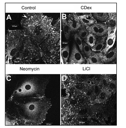 Figure 1 Immunofluorescence images showing the effect of changes in DRM lipid composition on vinculin-stained focal adhesions. (A) Cultured collecting duct cells labeled for vinculin, displaying typical focal adhesions. (B–D) Cultured collecting duct cells treated with 5 mM methyl-β-cyclodextrin, 1 mM neomycin or 10 mM LiCl, respectively. Note the dissipation of vinculin-stained FAs [compare with non-treated cells in (A)]. Arrowhead: focal adhesions. Bars: 20 µm.