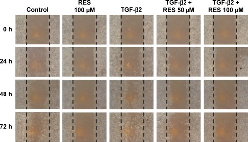 Figure 3 Effects of resveratrol on wound closure in TGF-β2-treated ARPE-19 cells.
