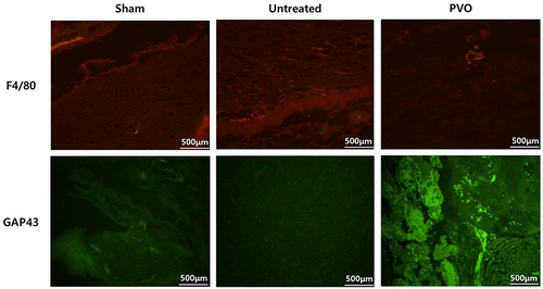 Figure 7 Immunofluorescence staining. The PVO group exhibits reduced F4/80 (macrophage marker) expression when compared with the sham and untreated groups. The PVO group shows higher GAP43 staining (nerve regeneration marker) at the site of neuritis than the sham and untreated groups.