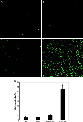 Figure 8 Cell apoptosis detection.Notes: Cell apoptosis was assessed by counting the number of Tunnel-positive cells in the field (five high-power fields per slide), and DMP–Gli1si (D) was superior to other controls in increasing cell apoptosis. DMP–Gli1si significantly increased apoptosis (**p<0.001, DMP–Gli1si vs NS [A], DMP (B), DMP–Consi [C]), and (E) mean apoptosis cells every five fields.Abbreviations: DMP, 1,2-dioleoyl-3-trimethylammonium-propane and methoxy poly(ethylene glycol)-poly(lactide) copolymer; NS, normal salt.