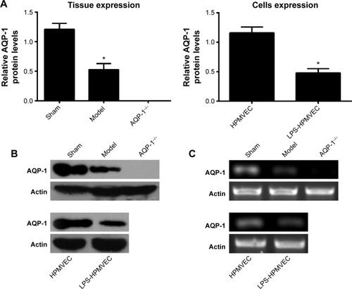 Figure 2 The level of AQP-1 expression in the pancreatitis-associated lung injuries measured in the animal models and at the cellular level.