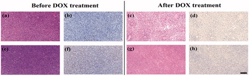 Figure 6. H&E staining (a, c, e, and g) and TUNEL assay (b, d, f, and h) of C6 xenografted tumors injected with 99mTc-duramycin-Au DENPs (a, b, c, and d) or 99mTc-Au DENPs (e, f, g, and h) before and after DOX treatment. The scale bar shown in all panels represents 200 μm.